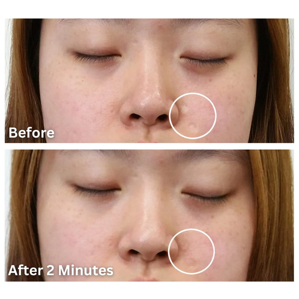 Bronze Medium Waterproof Scar Filler Concealer Refill Applicator S4450